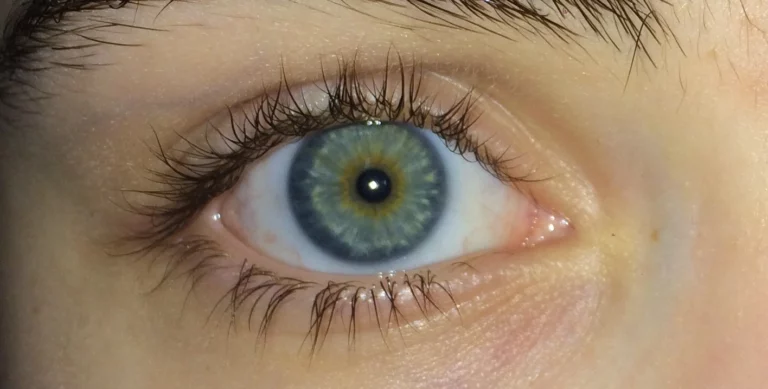 Spiritual Meaning of Blue Rings Around Brown Eyes