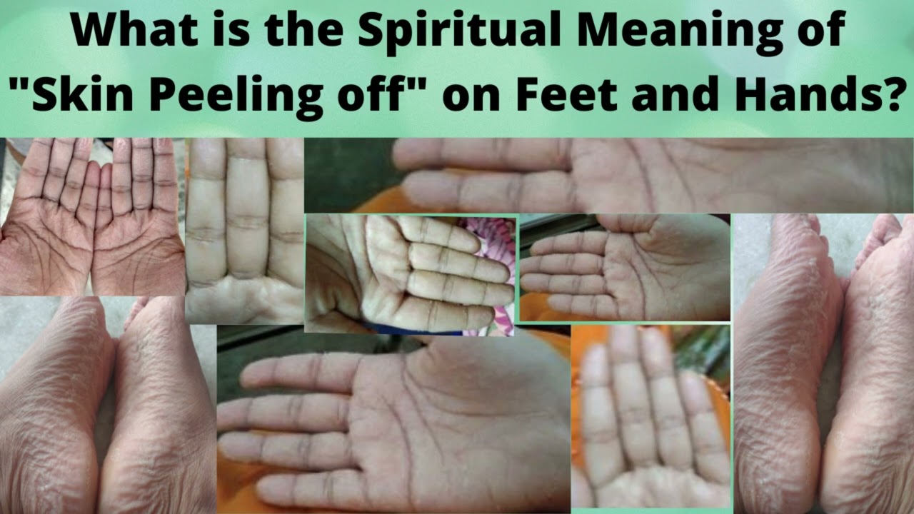 What Does Peeling Hands Mean Spiritually?