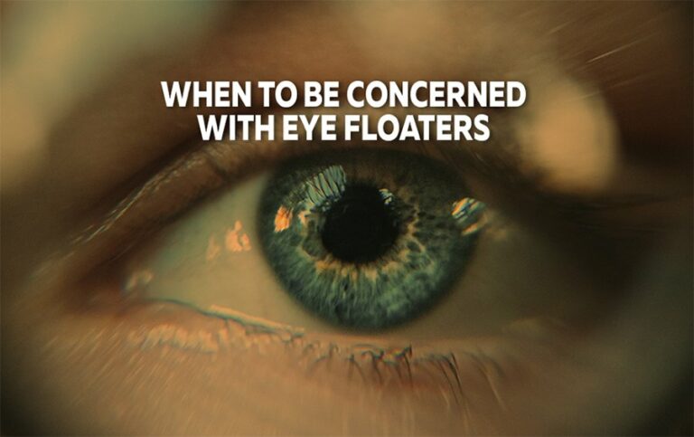 The Spiritual Interpretations of Eye Floaters
